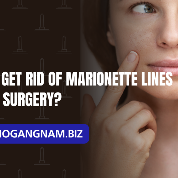Can You Get Rid of Marionette Lines Without Surgery?