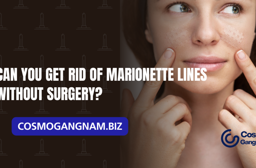 Can You Get Rid of Marionette Lines Without Surgery?
