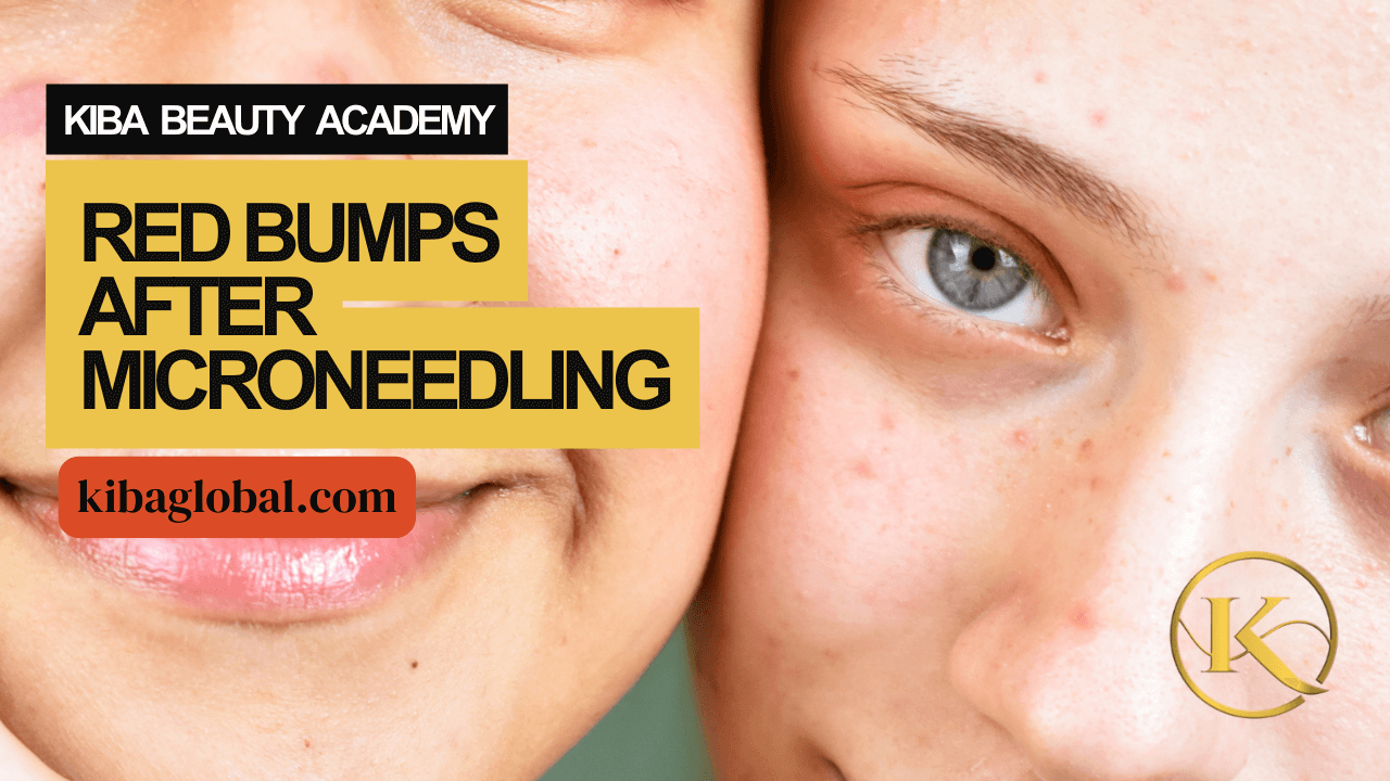 Red Bumps After Microneedling