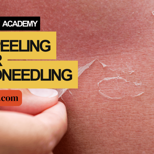 Skin Peeling After Microneedling