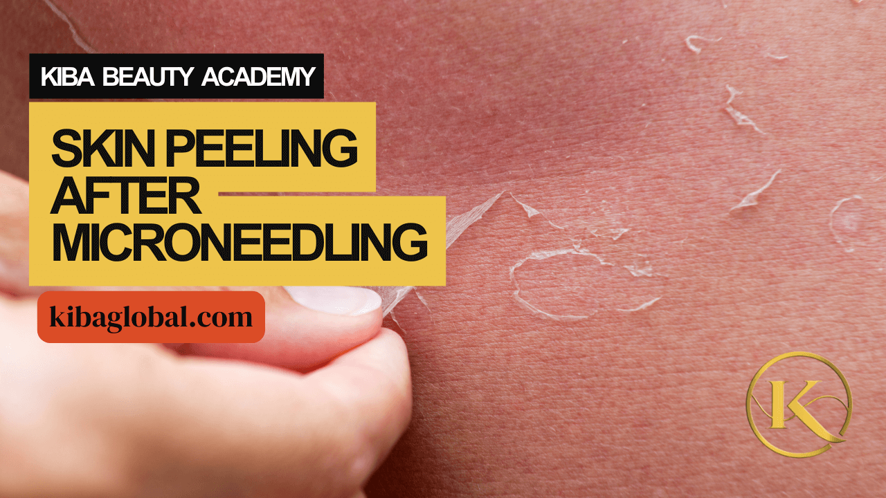 Skin Peeling After Microneedling