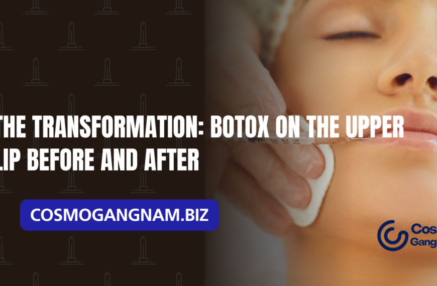 Botox on the Upper Lip Before and After