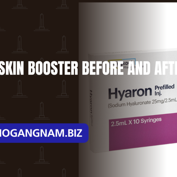 Hyaron skin booster before and after